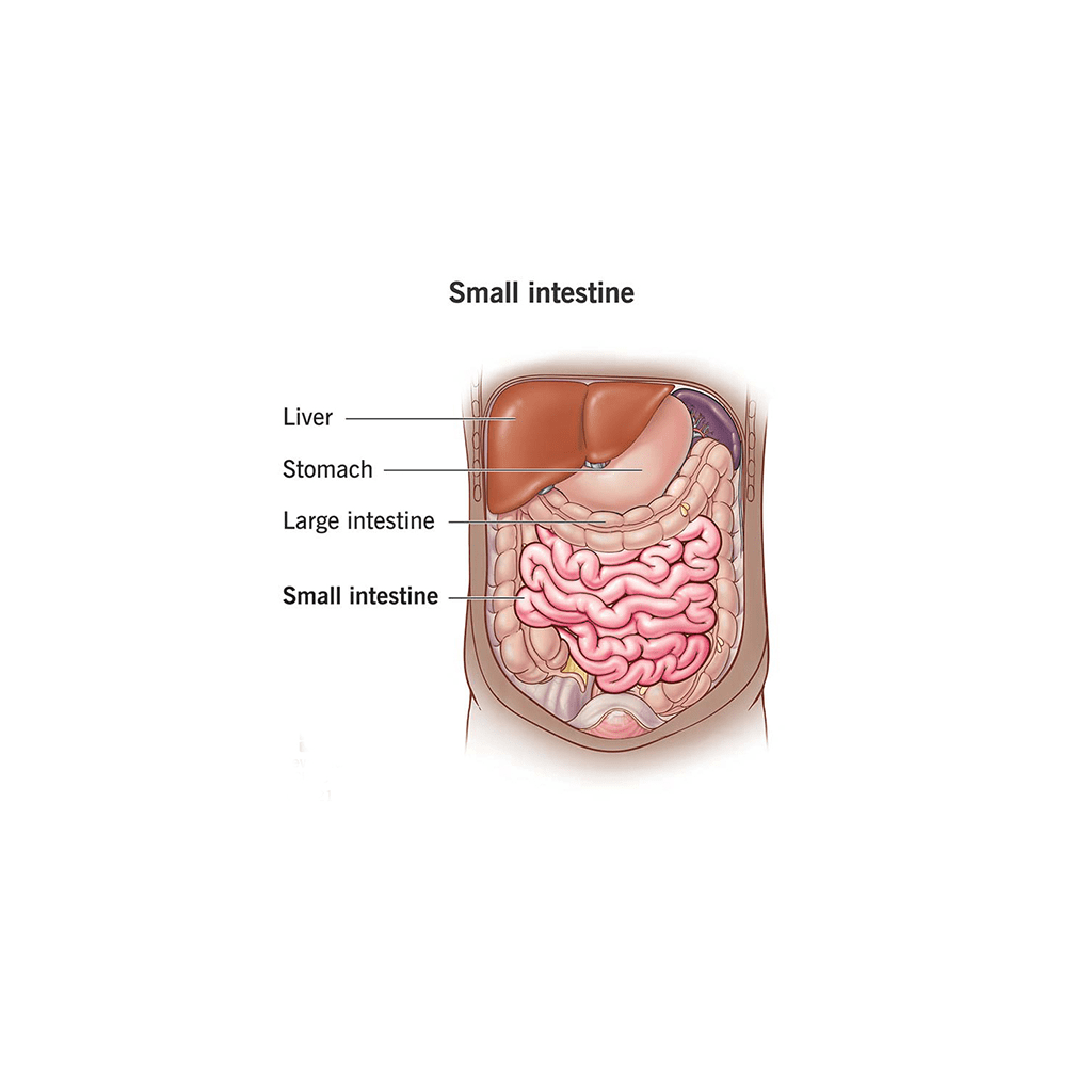 Hernia Medical Illustration
