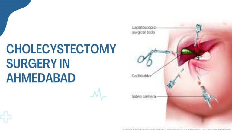 Laparoscopic cholecystectomy In Ahmedabad