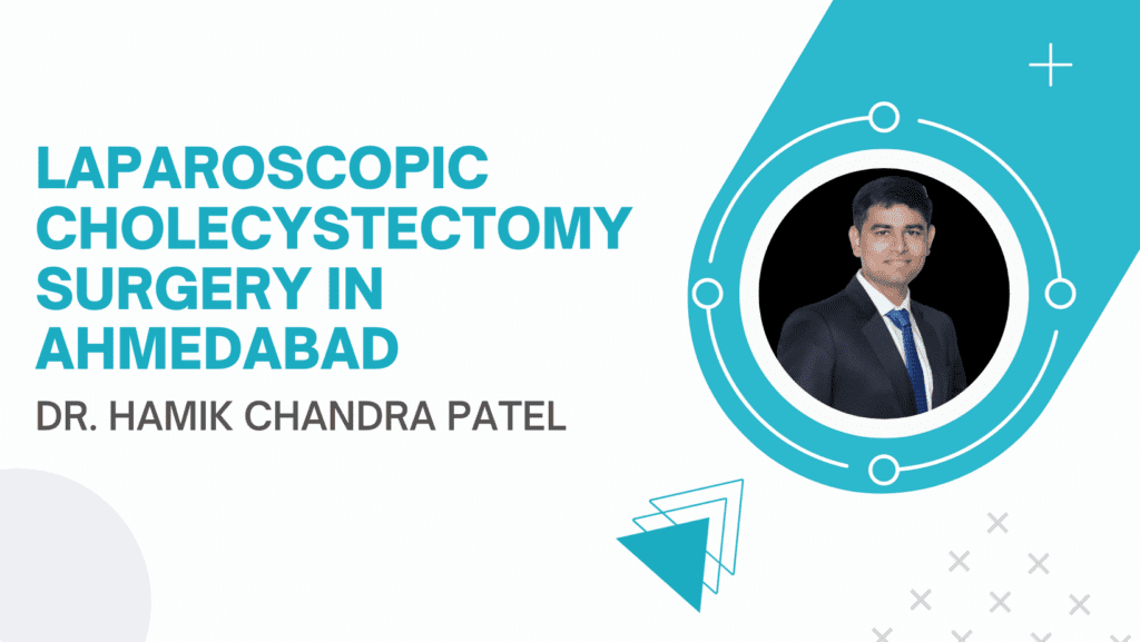 Best Laparoscopic Cholecystectomy in Ahmedabad