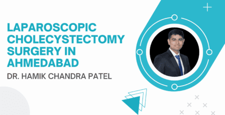 Best Laparoscopic Cholecystectomy in Ahmedabad