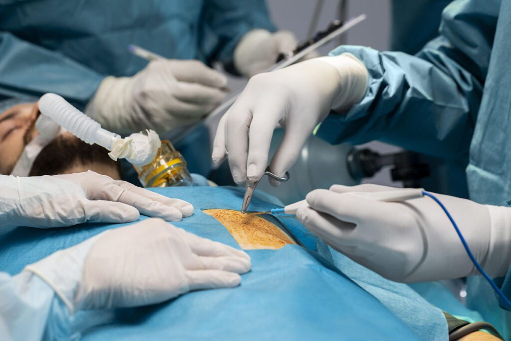 Best Laparoscopic Cholecystectomy Surgery In ahmedabad