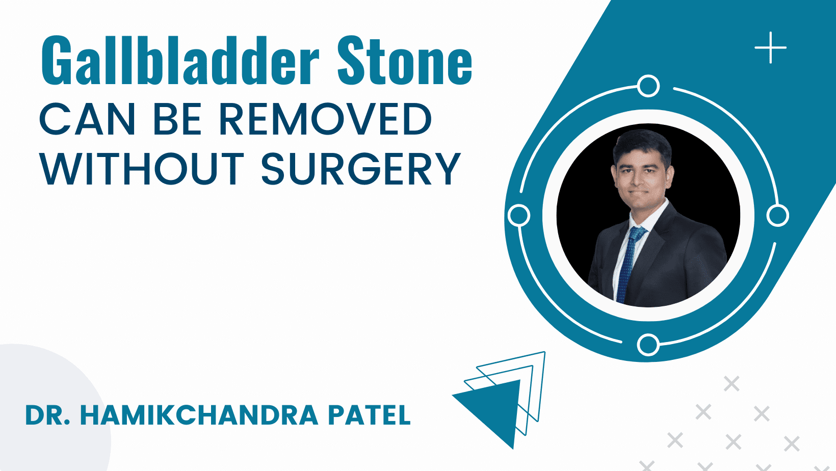 Gallbladder stone can be removed without surgery