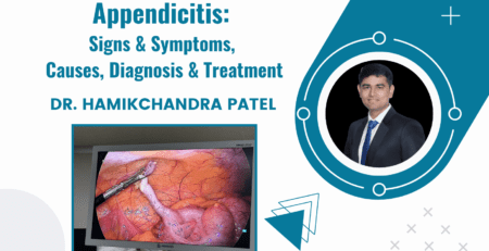 Appendicitis: Signs & Symptoms, Causes, Diagnosis & Treatment