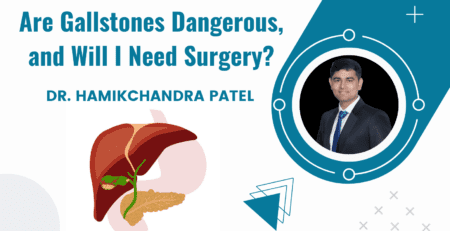 Are Gallstones Dangerous, and Will I Need Surgery