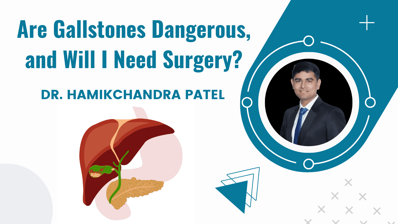 Are Gallstones Dangerous, and Will I Need Surgery