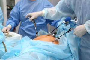 Best Laparoscopic Surgeon in Ahmedabad