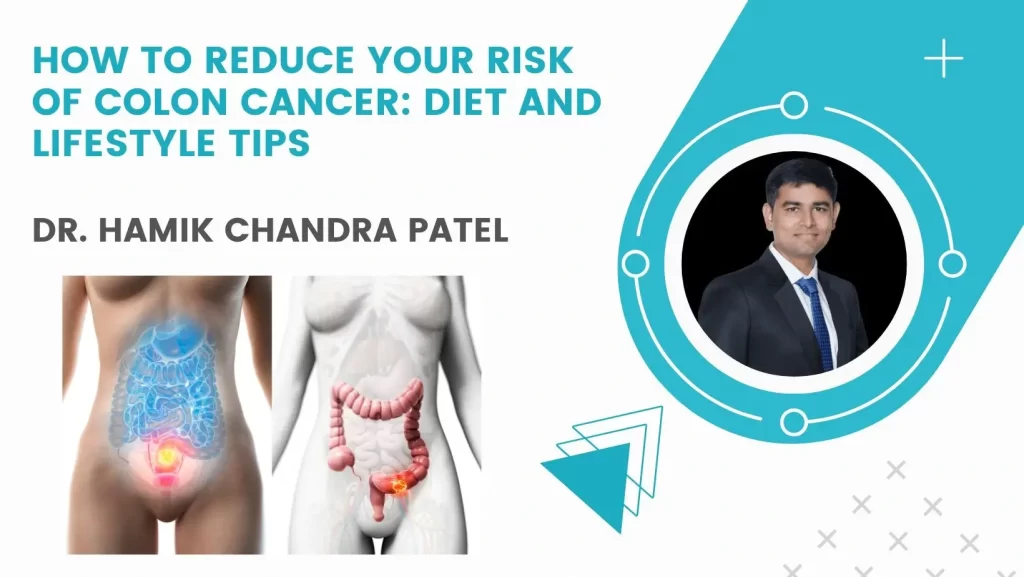 How to Reduce Your Risk of Colon Cancer: Diet and Lifestyle Tips
