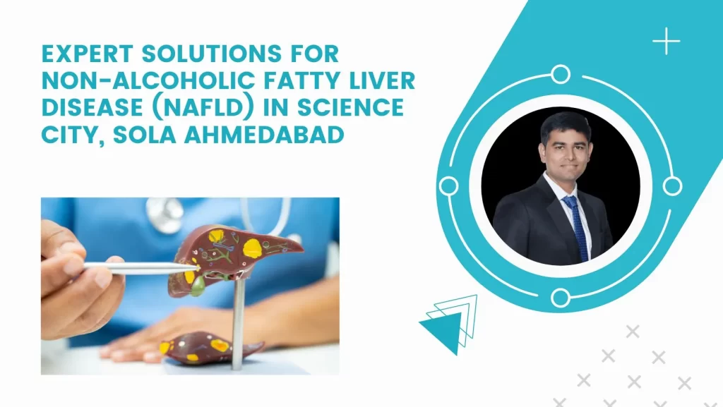 Expert Solutions for Non-Alcoholic Fatty Liver Disease (NAFLD) in Science City, Sola Ahmedabad