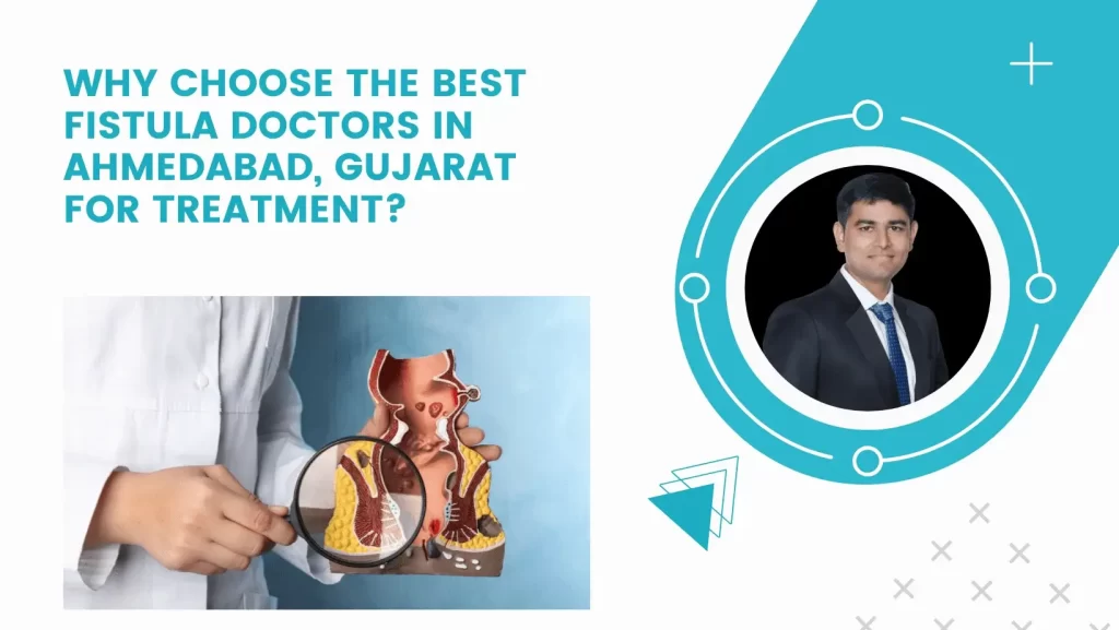 Why Choose the Best Fistula Doctors in Ahmedabad, Gujarat for Treatment?