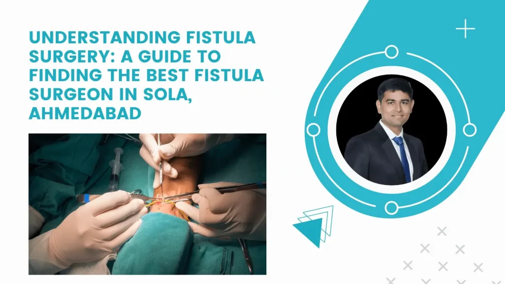Understanding Fistula Surgery: A Guide to Finding the Best Fistula Surgeon in Sola, Ahmedabad
