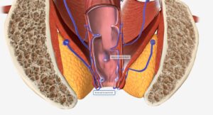 best fistula doctors