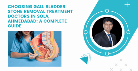Gall Bladder Stone Removal Treatment Doctors in Sola