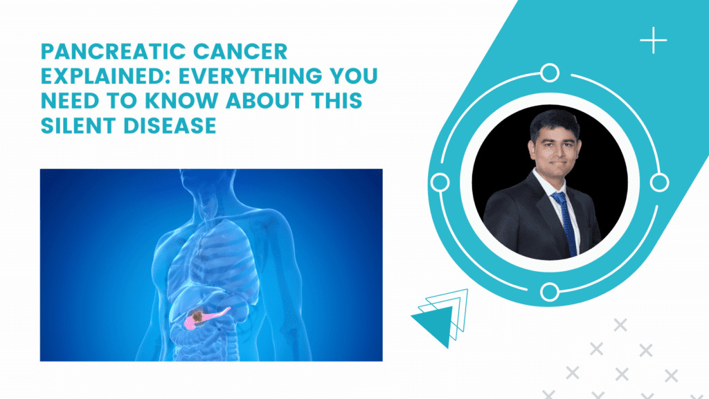 Pancreatic Cancer Explained: Everything You Need to Know About This Silent Disease