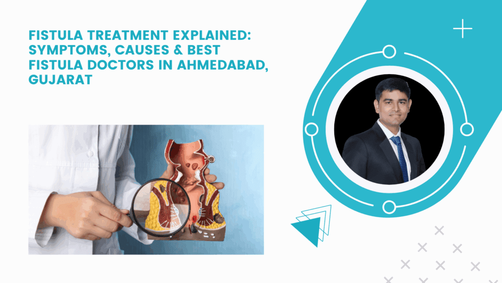 Fistula Treatment Explained: Symptoms, Causes & Best Fistula Doctors in Ahmedabad, Gujarat