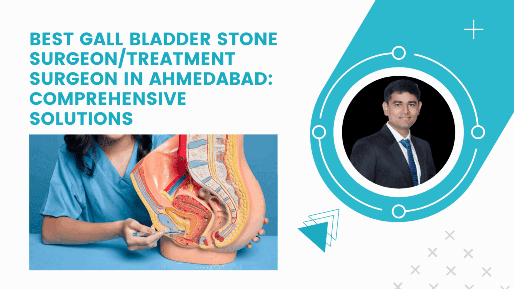 Best Gall Bladder Stone Surgeon/Treatment Surgeon in Ahmedabad: Comprehensive Solutions