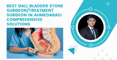 Best Gall Bladder Stone Surgeon