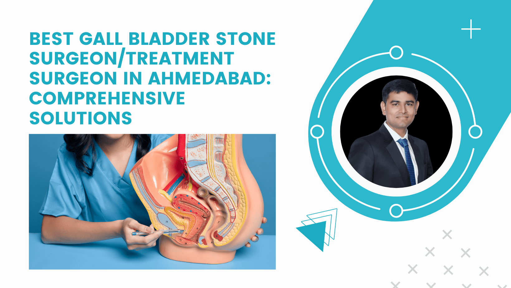 Best Gall Bladder Stone Surgeon