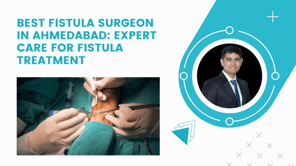 Best Fistula Surgeon in Ahmedabad: Expert Care for Fistula Treatment