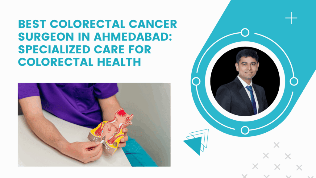 Best Colorectal Cancer Surgeon in Ahmedabad: Specialized Care for Colorectal Health