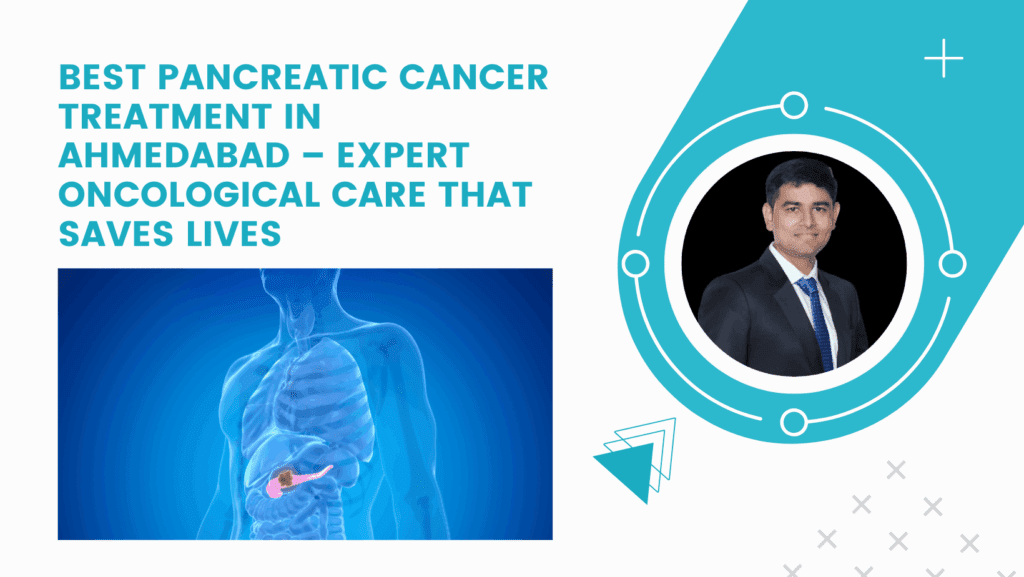 Best Pancreatic Cancer Treatment in Ahmedabad – Expert Oncological Care That Saves Lives