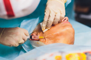 Top Pilonidal Sinus Surgeon in Sola, Ahmedabad