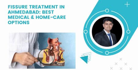 Fissure Treatment in Ahmedabad