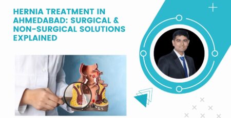 hernia treatment in ahmedabad
