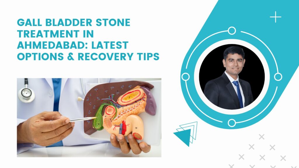 Gall Bladder Stone Treatment in Ahmedabad: Latest Options & Recovery Tips