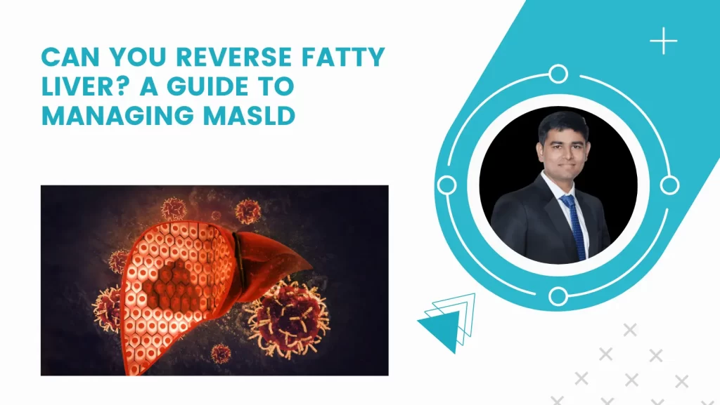 Can You Reverse Fatty Liver? A Guide to Managing MASLD