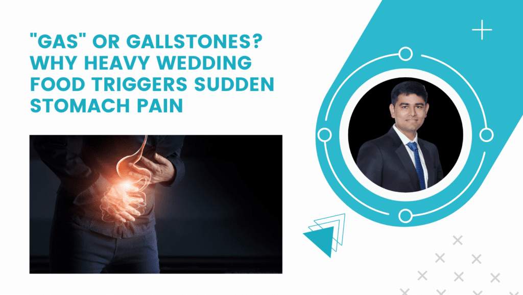 “Gas” or Gallstones? Why Heavy Wedding Food Triggers Sudden Stomach Pain