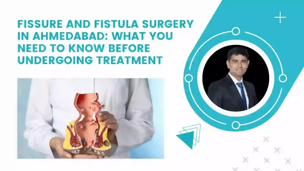 Fissure and Fistula Surgery in Ahmedabad: What You Need to Know Before Undergoing Treatment