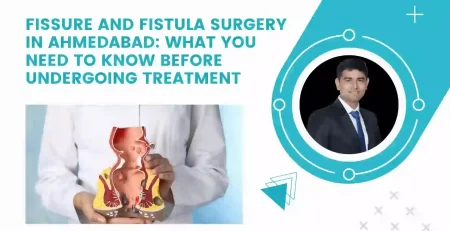 Fissure and Fistula Surgery in Ahmedabad