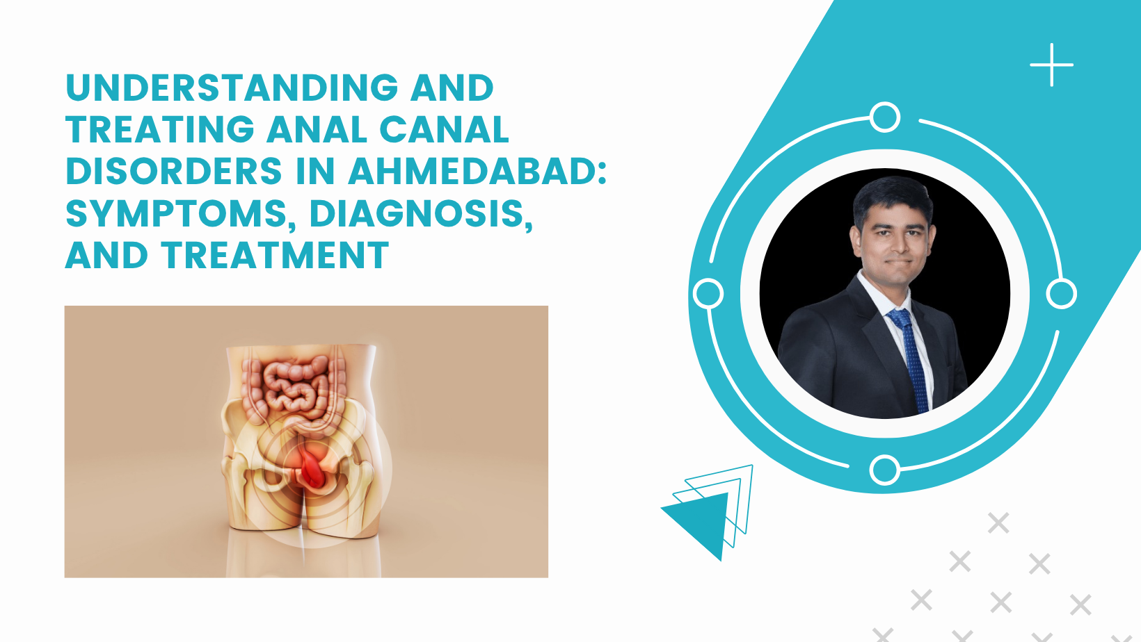 anal canal disorder
