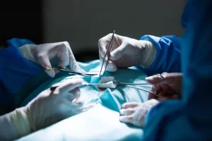 Fissure and fistula surgery in Ahmedabad