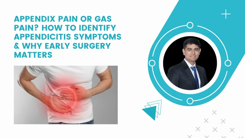 Appendix Pain or Gas Pain? How to Identify Appendicitis Symptoms & Why Early Surgery Matters