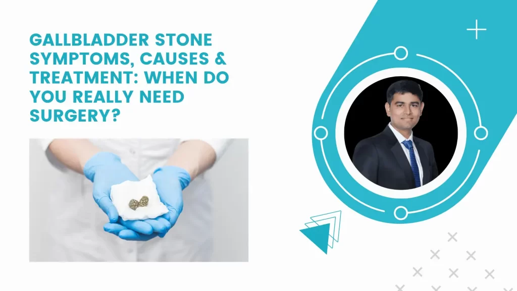Gallbladder Stone Symptoms, Causes & Treatment: When Do You Really Need Surgery?