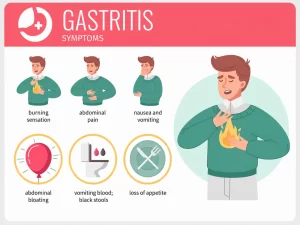  Acidity and Acid Reflux
