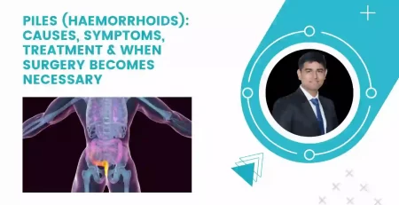 piles treatment